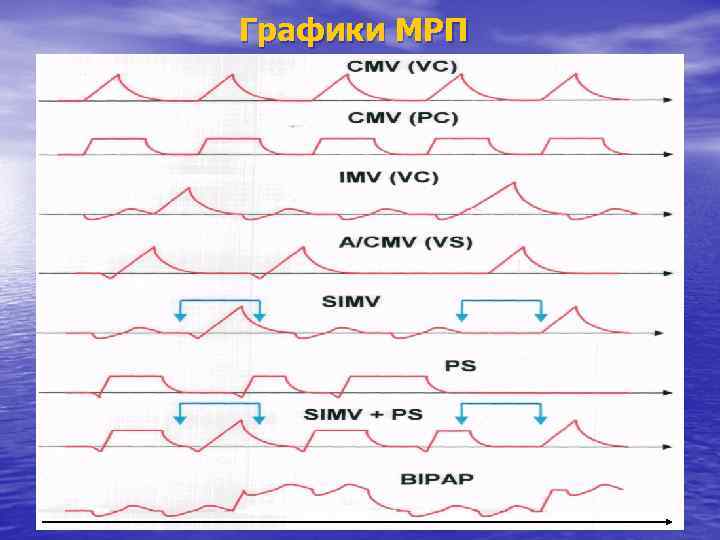 Графики МРП 46 