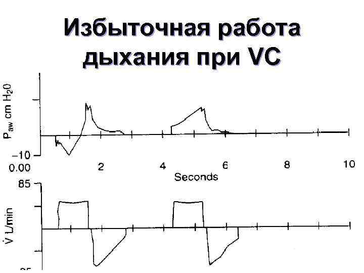 Избыточная работа дыхания при VC 49 