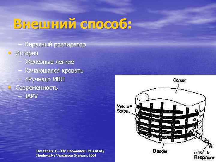 Внешний способ: – Кирасный респиратор • История – Железные легкие – Качающаяся кровать –