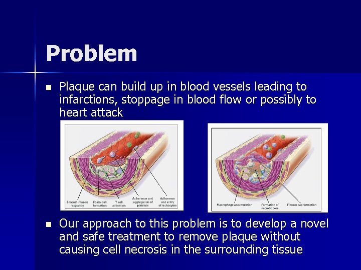 Problem n Plaque can build up in blood vessels leading to infarctions, stoppage in