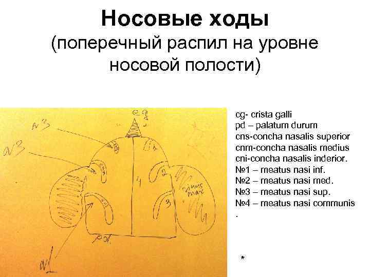 Носовые ходы (поперечный распил на уровне носовой полости) cg- crista galli pd – palatum