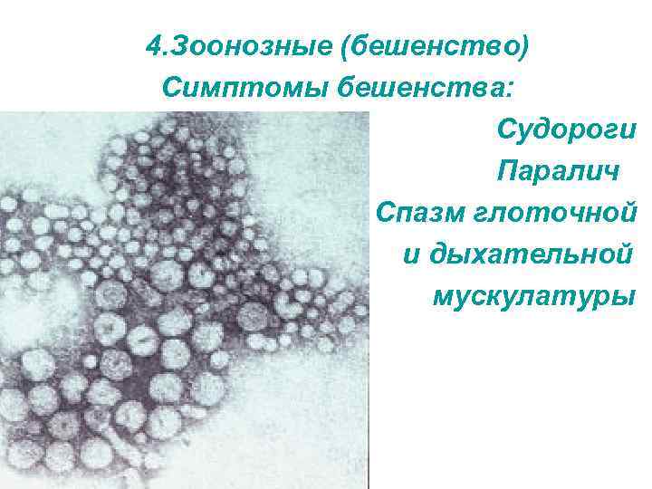 4. Зоонозные (бешенство) Симптомы бешенства: Судороги Паралич Спазм глоточной и дыхательной мускулатуры 