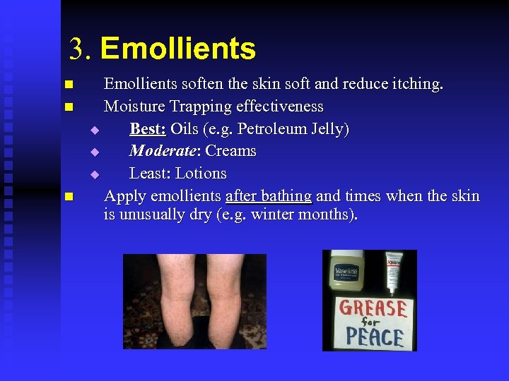 3. Emollients n n n Emollients soften the skin soft and reduce itching. Moisture