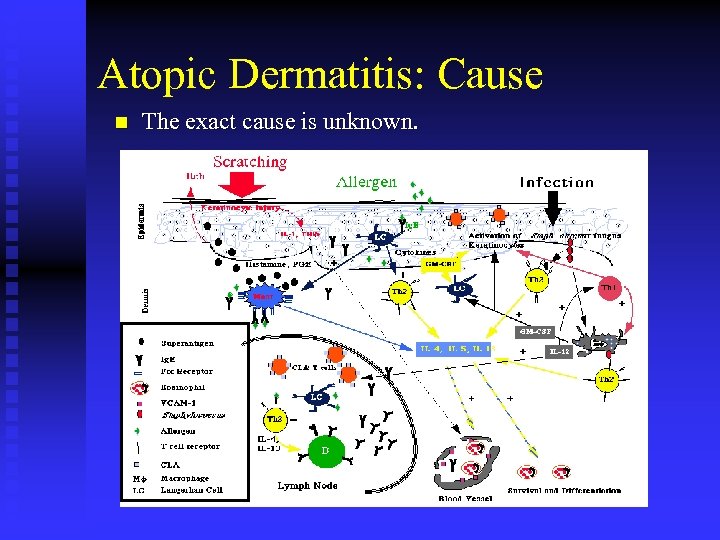 Atopic Dermatitis: Cause n The exact cause is unknown. 