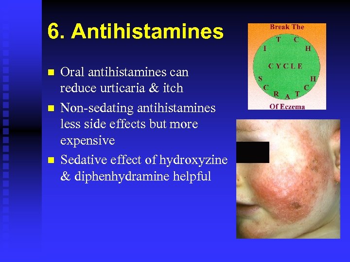 6. Antihistamines n n n Oral antihistamines can reduce urticaria & itch Non-sedating antihistamines