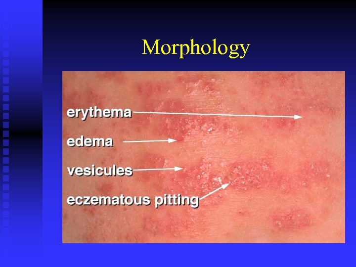 Morphology 