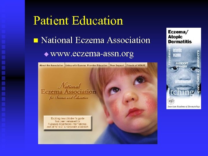 Patient Education n National Eczema Association u www. eczema-assn. org 