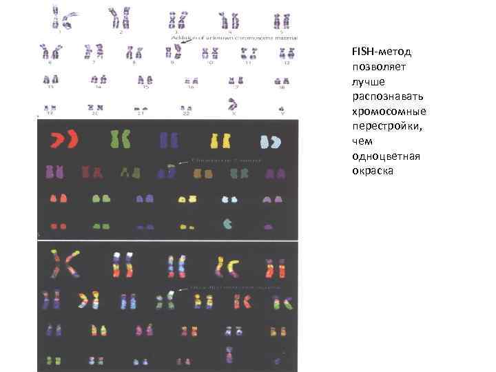 FISH-метод позволяет лучше распознавать хромосомные перестройки, чем одноцветная окраска 