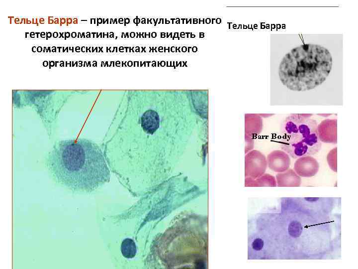 Тельце Барра – пример факультативного Тельце Барра гетерохроматина, можно видеть в соматических клетках женского