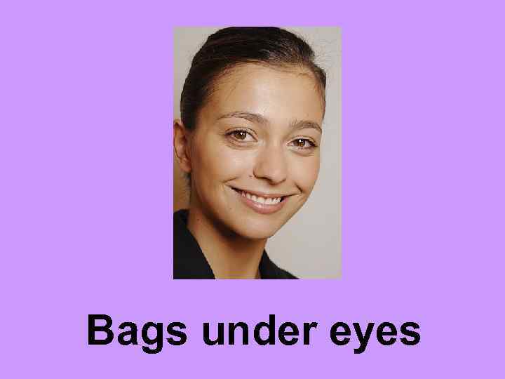 Bags under eyes 