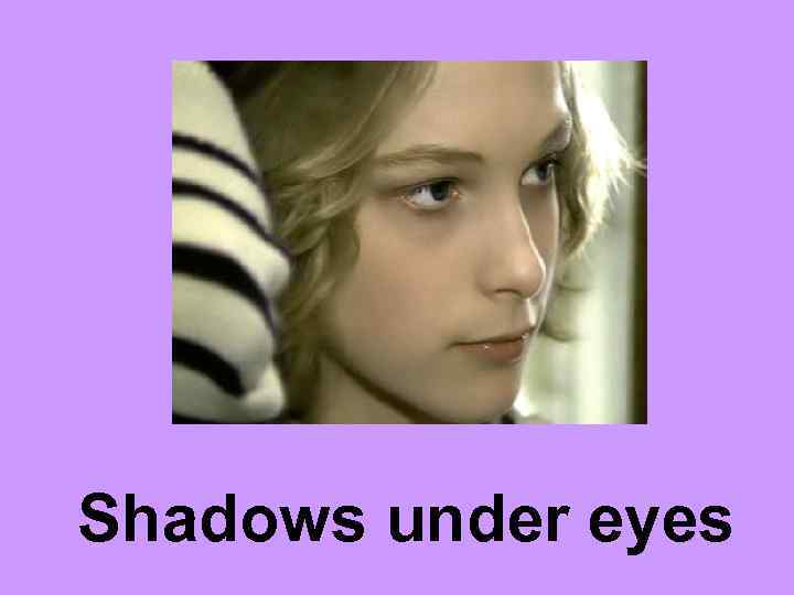 Shadows under eyes 