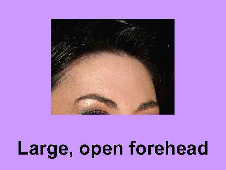 Large, open forehead 