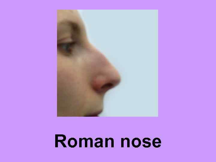 Roman nose 