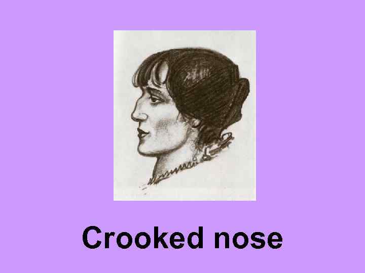 Crooked nose 