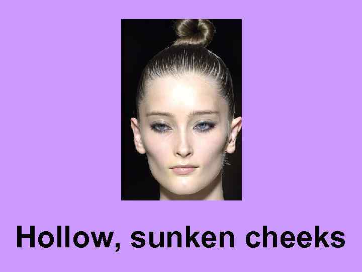 Hollow, sunken cheeks 