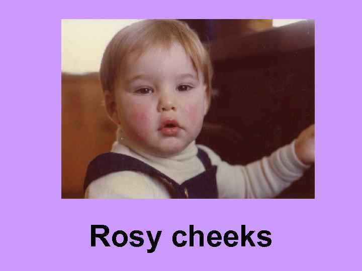 Rosy cheeks 