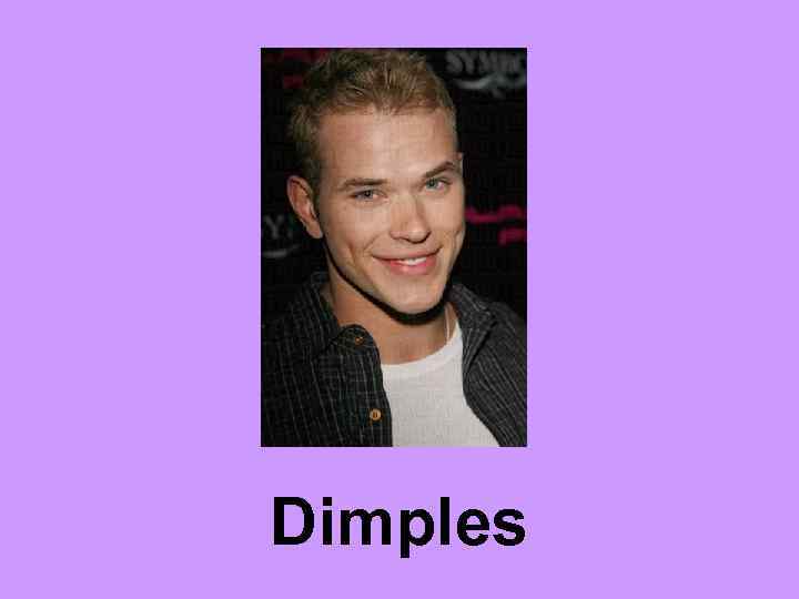 Dimples 