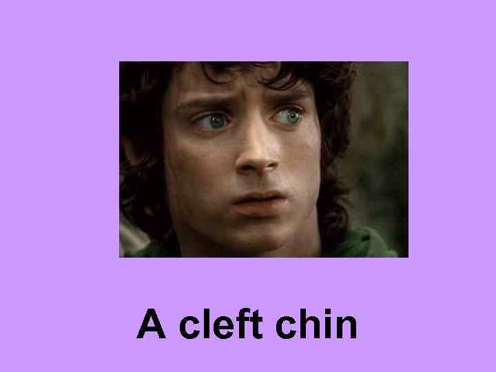 A cleft chin 