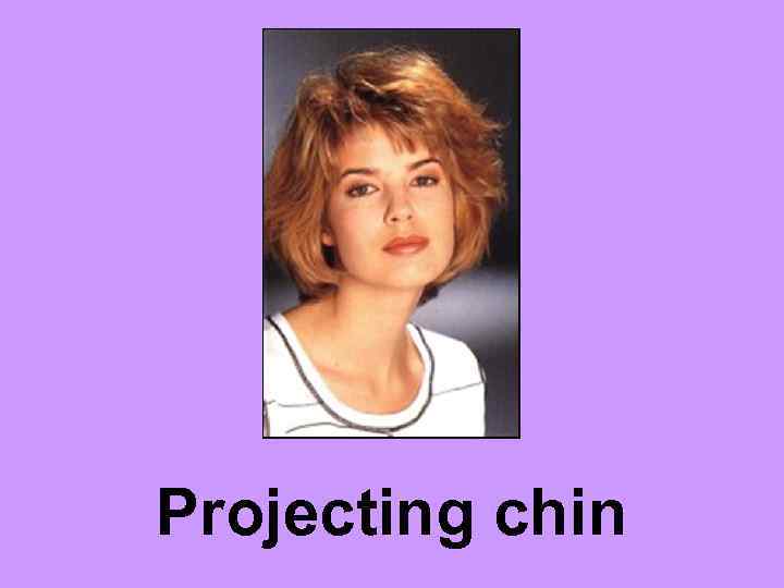 Projecting chin 