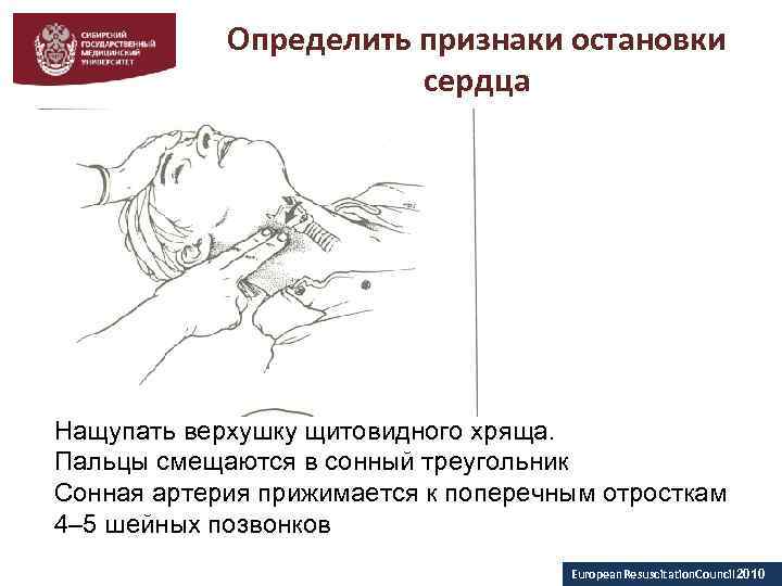 Признаком остановки сердца не является. Признаки остановки сердца. Определение признаки остановки сердечной деятельности.