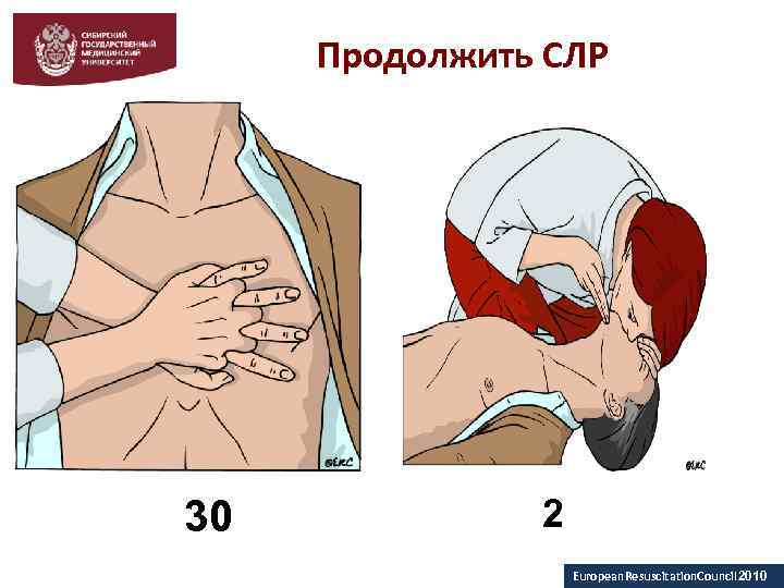 Базовая сердечная реанимация