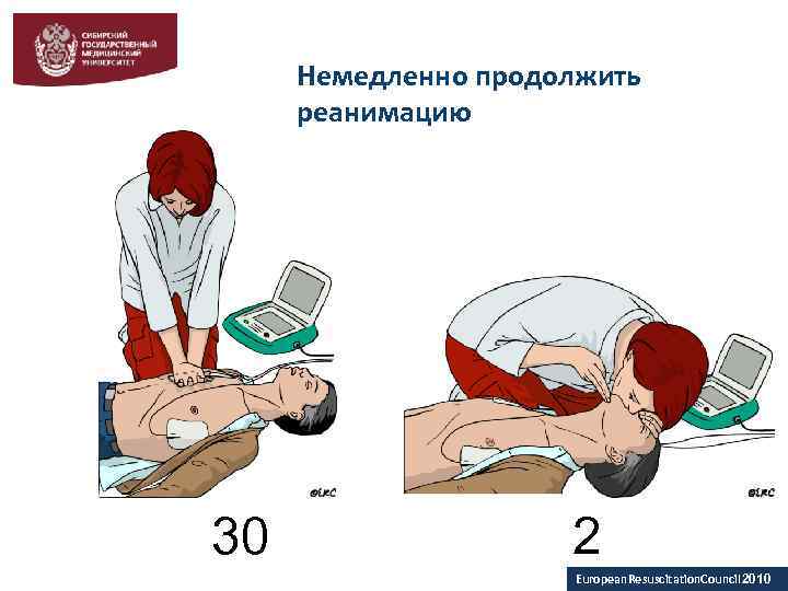 Немедленно продолжить реанимацию 30 2 European. Resuscitation. Council 2010 