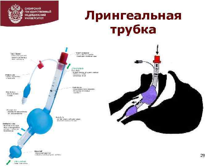 Лрингеальная трубка 29 