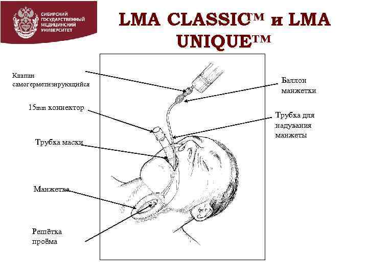 LMA CLASSIC и LMA ™ LMA CLASSIC™и LMA UNIQUE™ Клапан самогерметизирующийся 15 mm коннектор