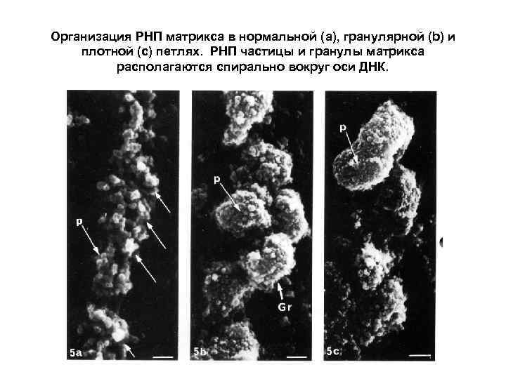 Организация РНП матрикса в нормальной (a), гранулярной (b) и плотной (с) петлях. РНП частицы