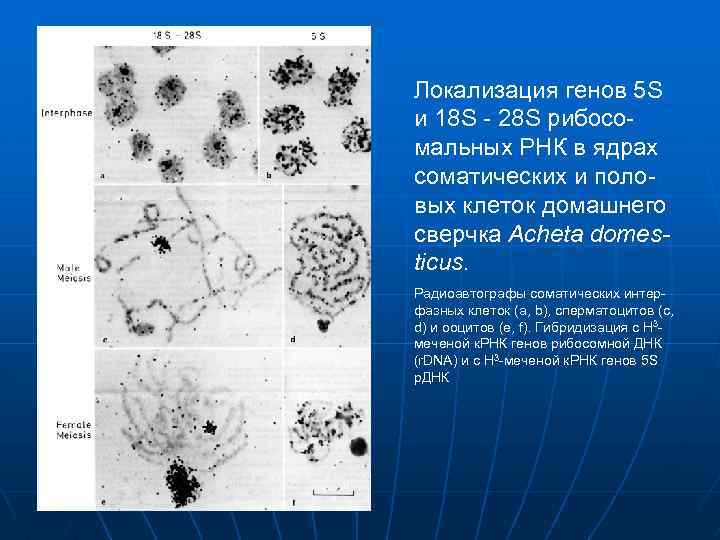 Локализация генов 5 S и 18 S - 28 S рибосомальных РНК в ядрах