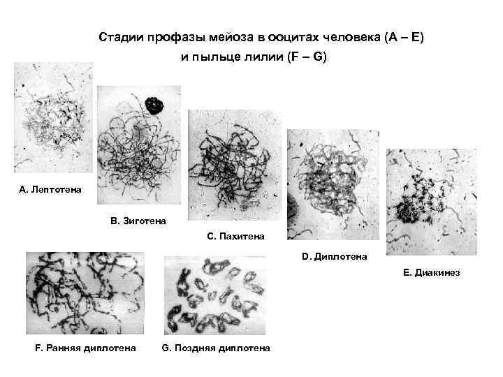 Стадии профазы мейоза в ооцитах человека (А – Е) и пыльце лилии (F –