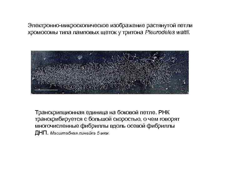 Электронно-микроскопическое изображение растянутой петли хромосомы типа ламповых щеток у тритона Pleurodeles waltli. Транскрипционная единица