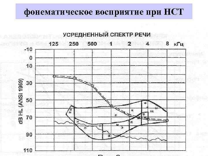 фонематическое восприятие при НСТ 