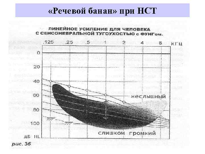  «Речевой банан» при НСТ 