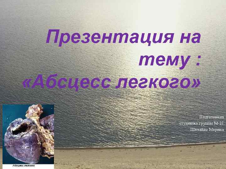 Презентация на тему : «Абсцесс легкого» Подготовила студентка группы М-21 Шихайло Марина 