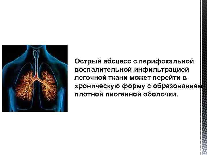 Острый абсцесс с перифокальной воспалительной инфильтрацией легочной ткани может перейти в хроническую форму с