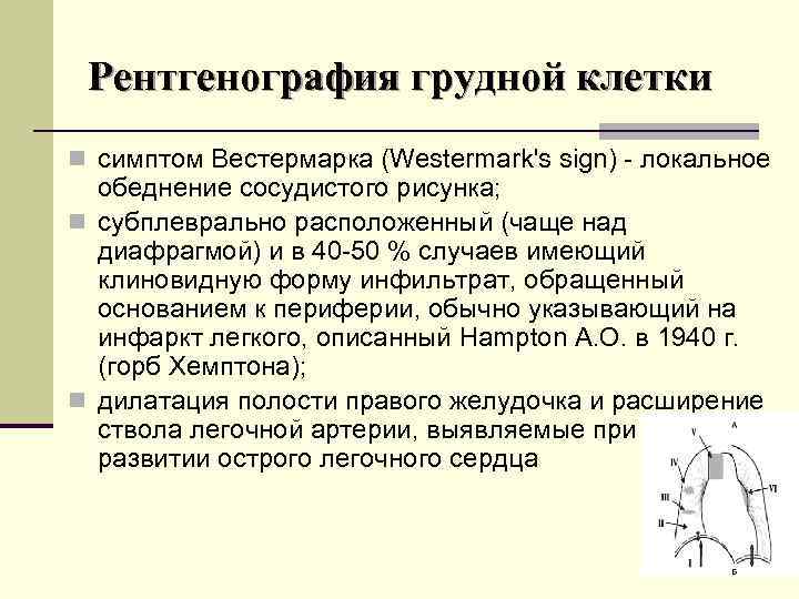 Рентгенография грудной клетки n симптом Вестермарка (Westermark's sign) локальное обеднение сосудистого рисунка; n субплеврально