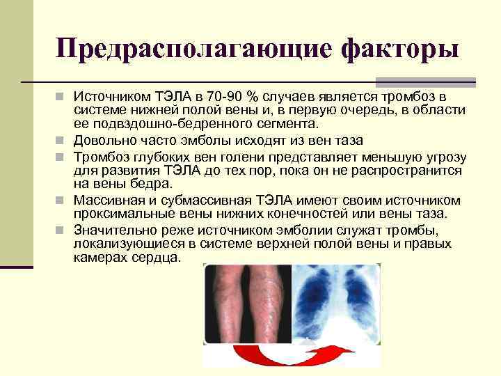 Предрасполагающие факторы n Источником ТЭЛА в 70 90 % случаев является тромбоз в n