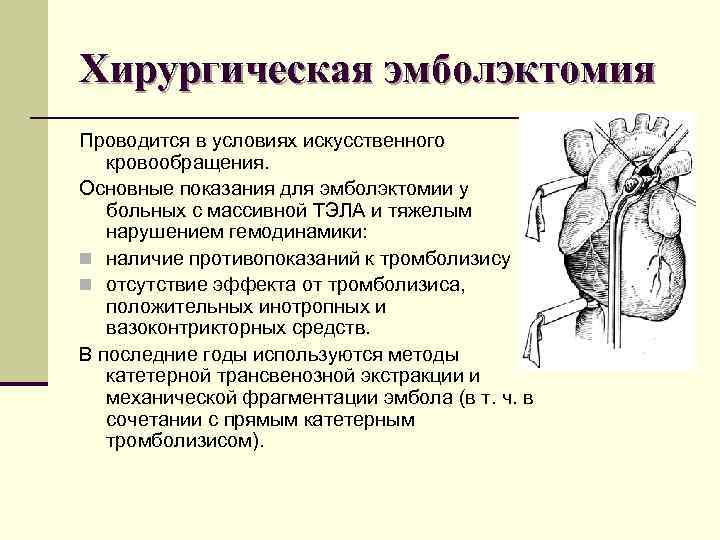 Хирургическая эмболэктомия Проводится в условиях искусственного кровообращения. Основные показания для эмболэктомии у больных с