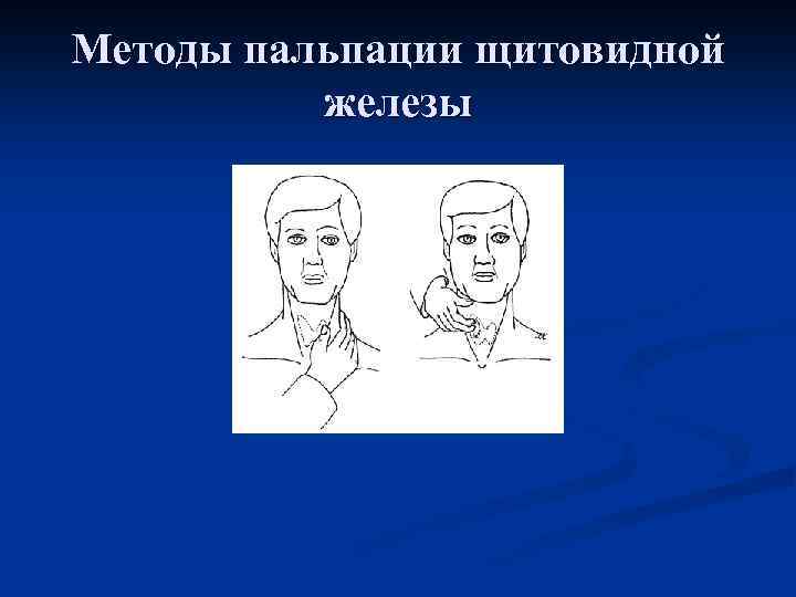 Пальпация щитовидной железы презентация