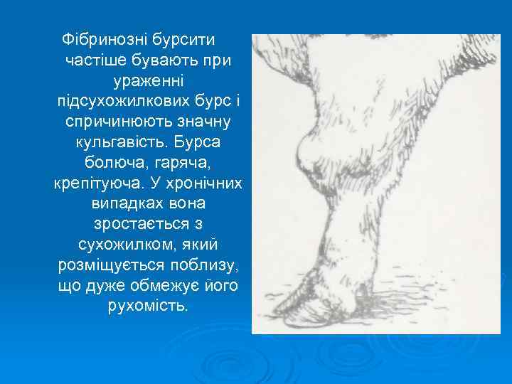 Фібринозні бурсити частіше бувають при ураженні підсухожилкових бурс і спричинюють значну кульгавість. Бурса болюча,