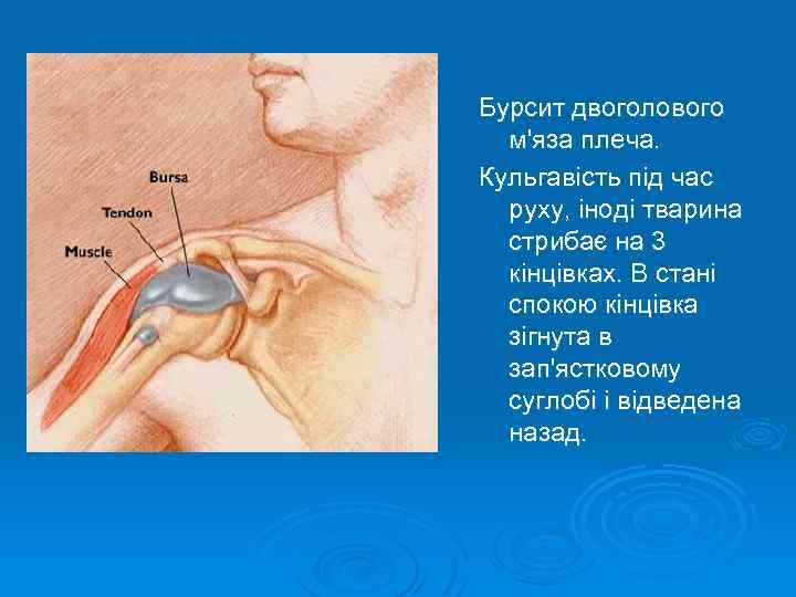 Бурсит двоголового м'яза плеча. Кульгавість під час руху, іноді тварина стрибає на 3 кінцівках.