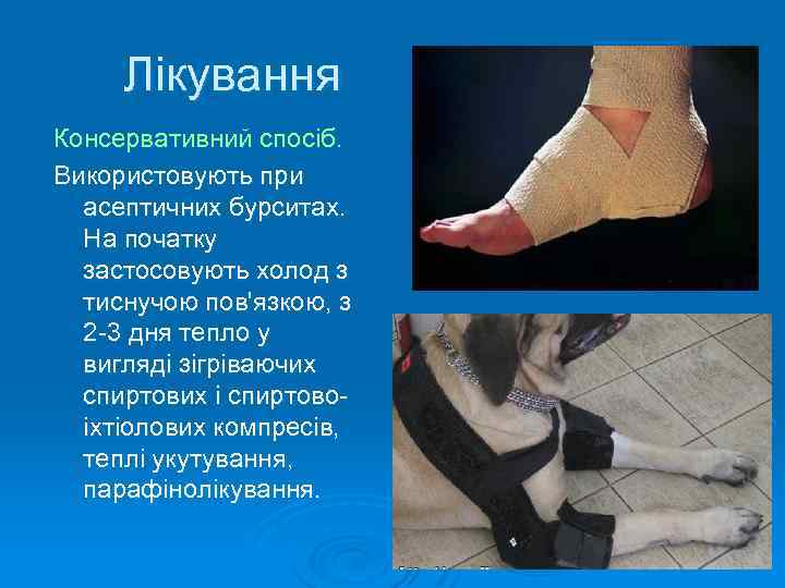 Лікування Консервативний спосіб. Використовують при асептичних бурситах. На початку застосовують холод з тиснучою пов'язкою,