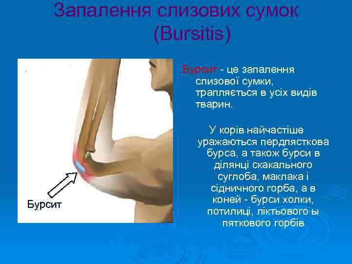 Запалення слизових сумок (Bursitis) Бурсит - це запалення слизової сумки, трапляється в усіх видів