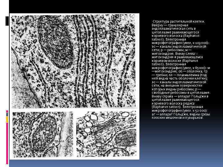 Структура растительной клетки. Вверху — гранулярная эндоплазматическая сеть в цитоплазме развивающегося корневого волоска (Raphanus