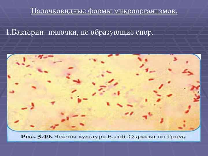 Палочковидные бактерии. Палочковидные микробиология по Граму. Грамотрицательные палочковидные бактерии. Грамотрицательные бациллы форма. Форма микроорганизмов палочка бацилла.