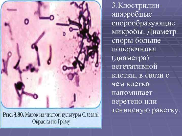 Образующие споры. Клостридии микробиология морфология. Бациллы-аэробные спорообразующие палочки.. Клостридии морфология спорообразующие. Спорообразующие бактерии бациллы клостридии.