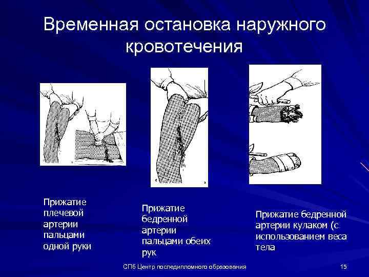 Пинок акпп при остановке