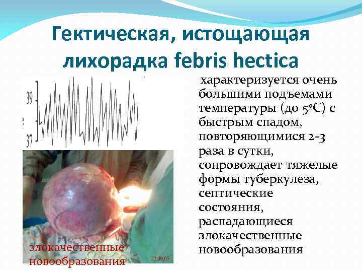 Клиническая картина лихорадки ку характеризуется