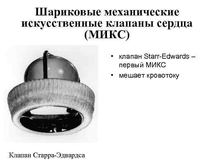Шариковые механические искусственные клапаны сердца (МИКС) • клапан Starr-Edwards – первый МИКС • мешает